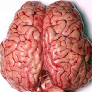 10 найновіших біотехнологій для здоров’я людини